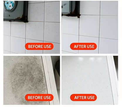 Symzora™ Advanced Deep-Root Mold & Mildew Remover Gel