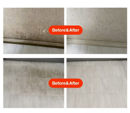 Symzora™ Advanced Deep-Root Mold & Mildew Remover Gel