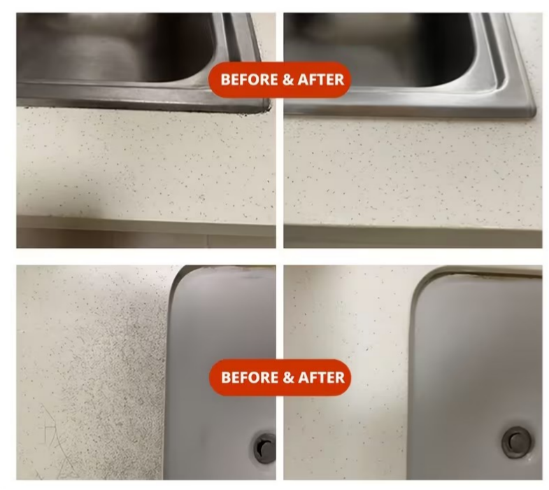 Symzora™ Advanced Deep-Root Mold & Mildew Remover Gel